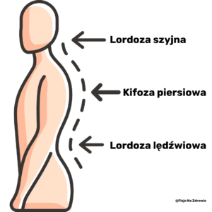 Lordoza szyjna